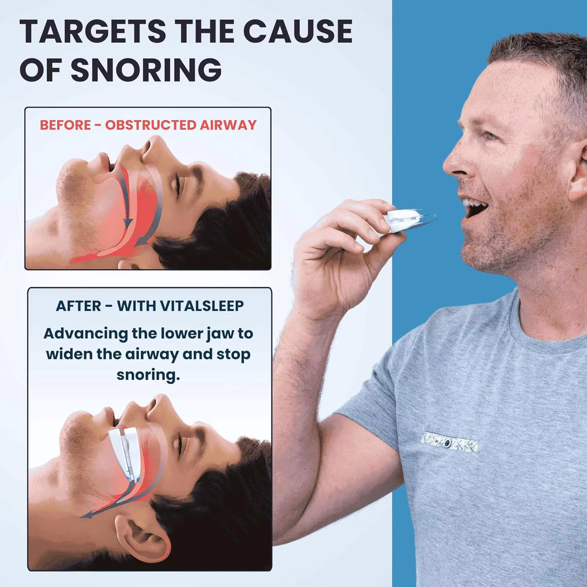 2-in-1 Anti-Snoring Mouthpiece & Bruxism Teeth Guard | Boil & Bite Custom Fit | 2 Pack