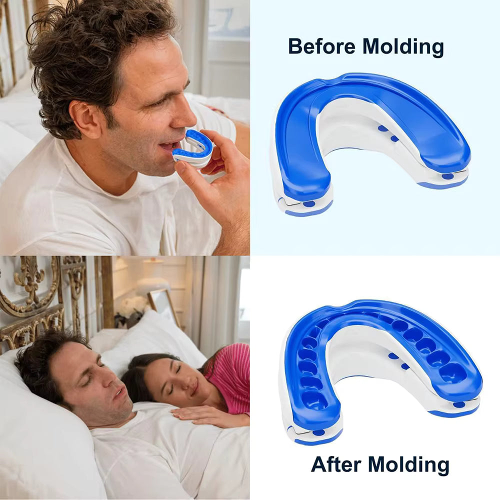 2-in-1 Anti-Snoring Mouthpiece & Bruxism Teeth Guard | Boil & Bite Custom Fit | 2 Pack