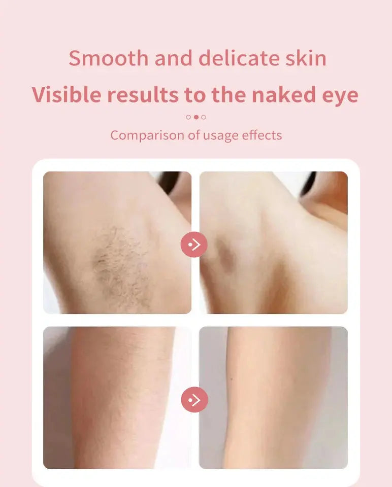 Women's 2-in-1 Silk Glide Epilator & Electric Shaver | Rechargeable Hair Removal OZAB